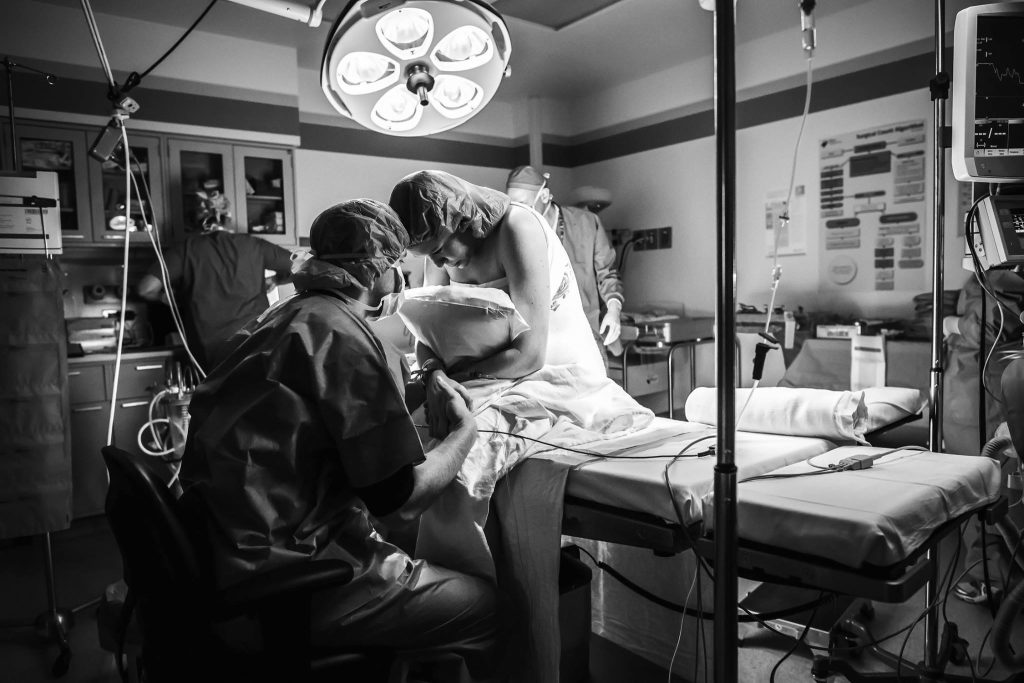 preparing for cesarean