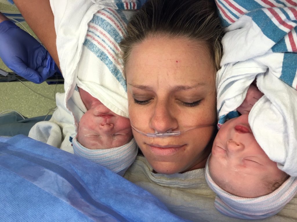 twins birth story