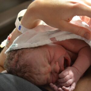 ECV for Breech Baby Birth Story