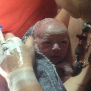Gestational Diabetes, Cesarean, and HBAC
