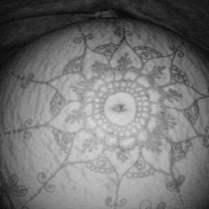 Preeclampsia Family Centered Cesarean & Gestational Diabetes VBA2C Birth Stories