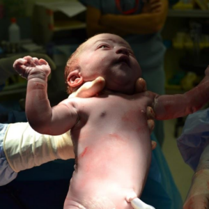 Breech Cesarean Birth Story in Canada