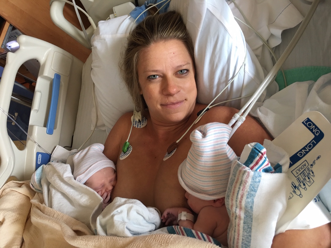 A Twin Story, from a Healthy Pregnancy to a Powerful Birth