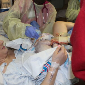 Pre-eclampsia Induced Birth at 36 Weeks