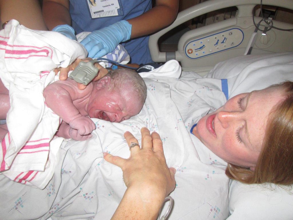 cesarean then 3 vbacs