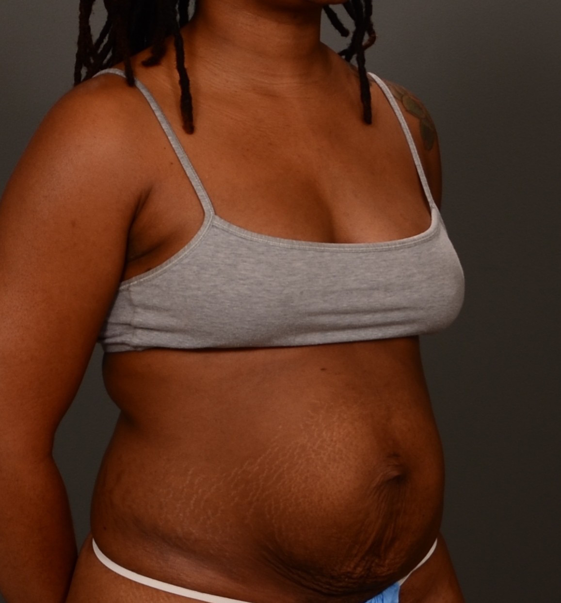 Peaceful Birth Center Birth and Hospital Induction with Posterior Baby