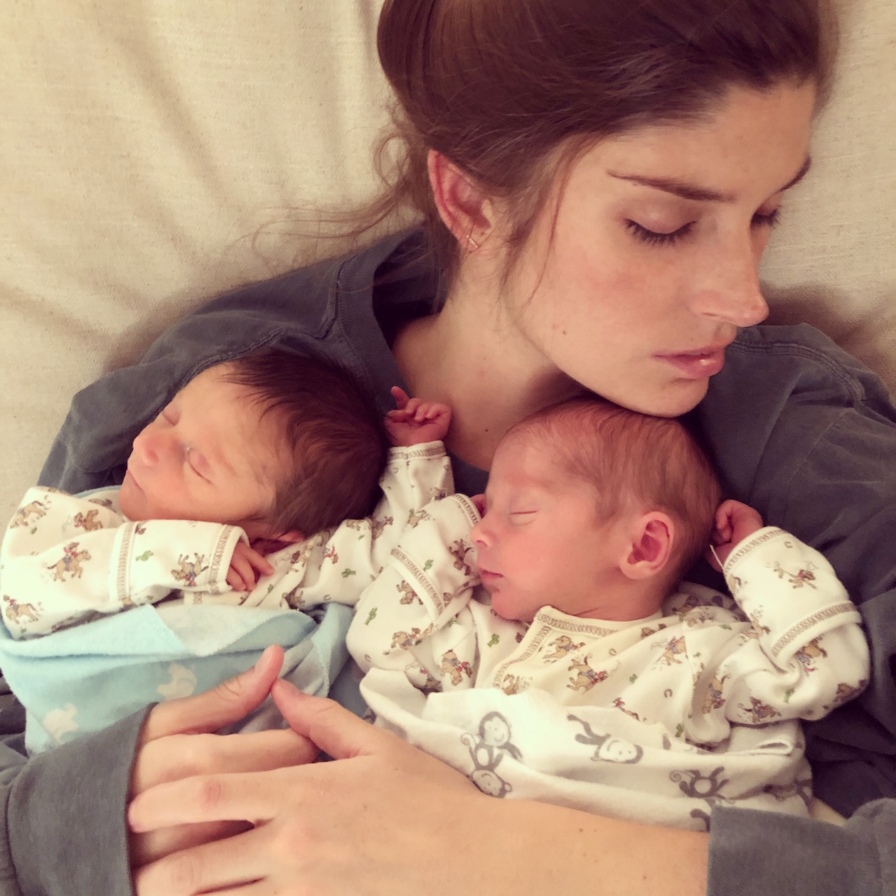 Unmedicated Twin Birth after Cholestasis Diagnoses