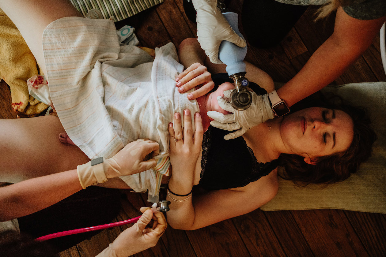 Shoulder Dystocia and Neonatal Resuscitation Homebirth Story
