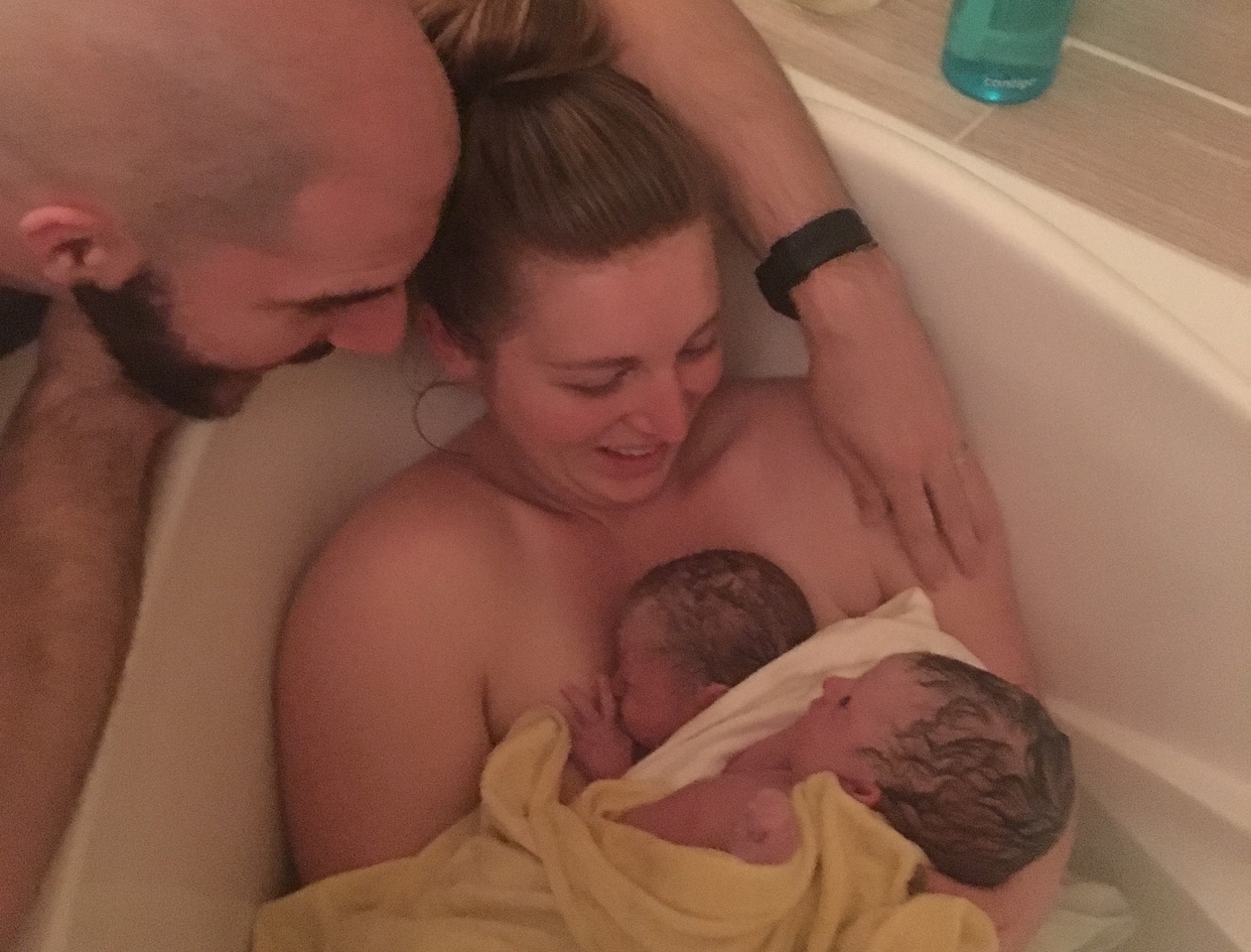 Birth Center Twin Birth with Dr. Stu & Hyperemesis Gravidarum
