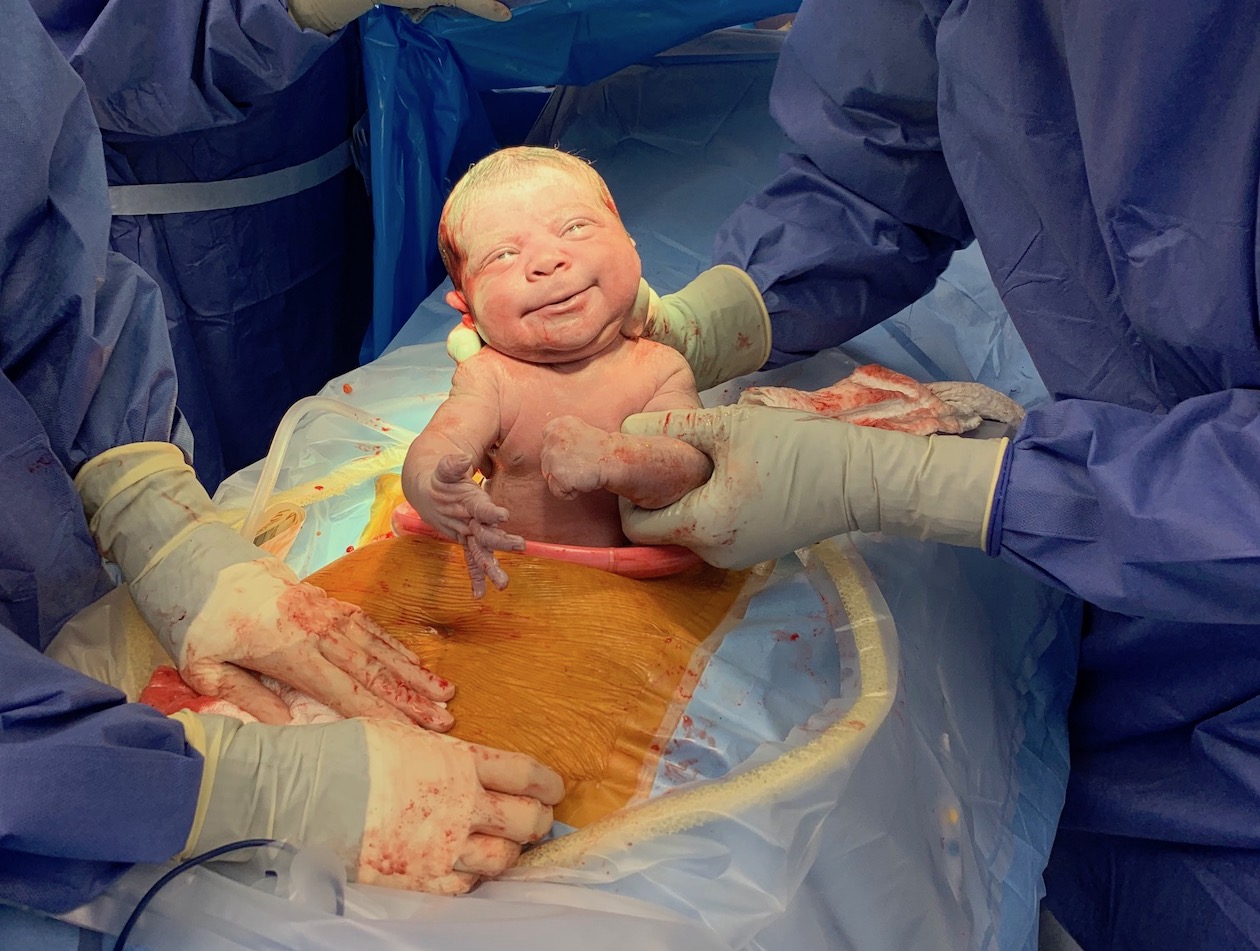 Cesarean Birth, Failed VBAC, No Regrets