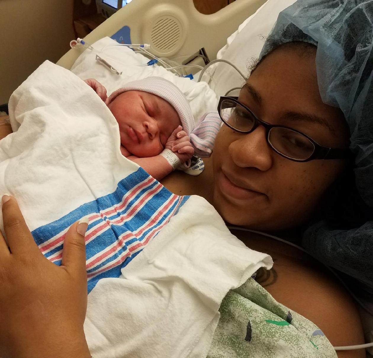 Cesarean Birth for Fibroid Followed by VBAC Birth Story