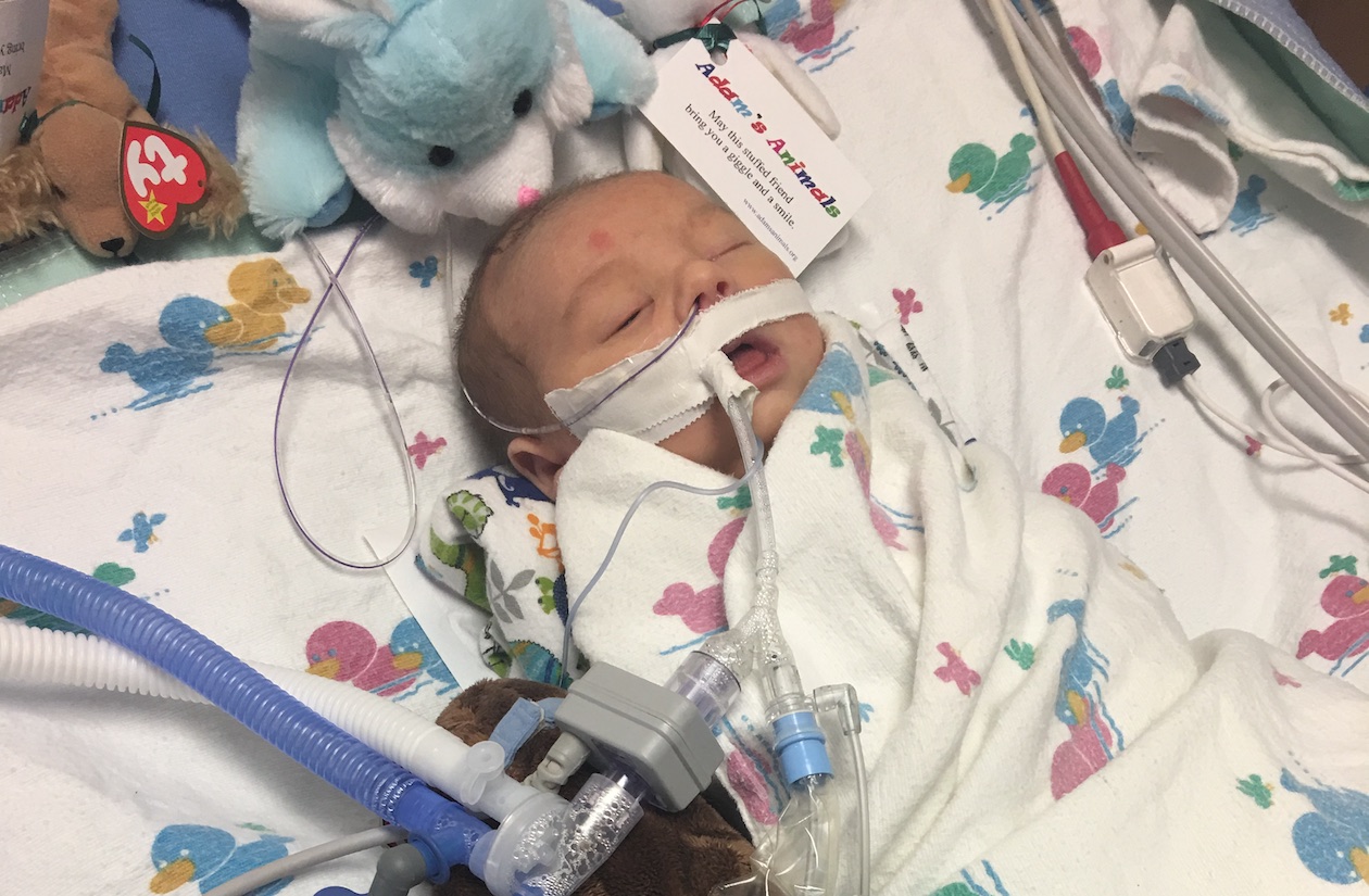 Group B Strep Positive – NICU Stay for Bacterial Meningitis