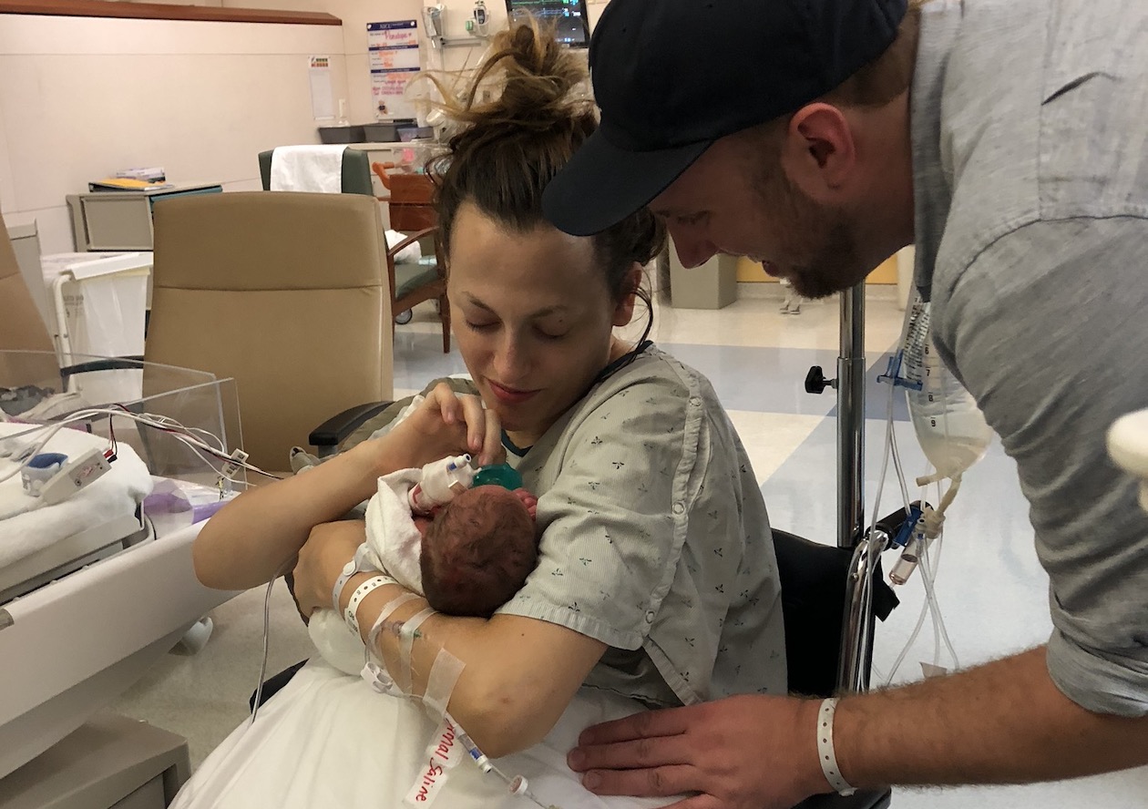 Type 1 Diabetes, Induction for Preeclampsia & Unplanned Cesarean