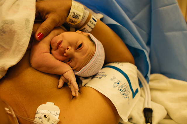 cesarean skin to skin