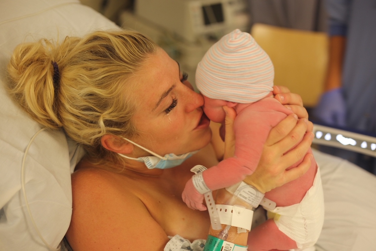 Fallopian Tube Cyst & Breech Baby Cesarean Birth