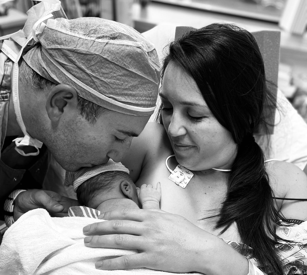 Cesarean Breech Delivery with Oligohydramnios