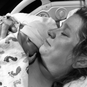 Partial Molar Pregnancy, Epidural and Epidural-free Midwife Hospital Births