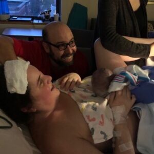 Epidural-free Induction and Insufficient Glandular Tissue Postpartum