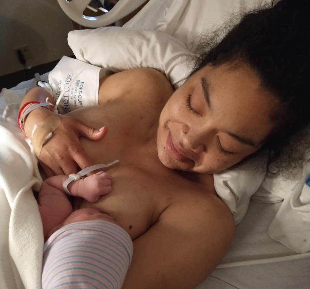 preeclampsia birth story