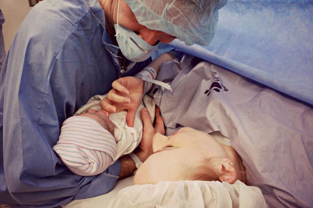 cesarean after loss