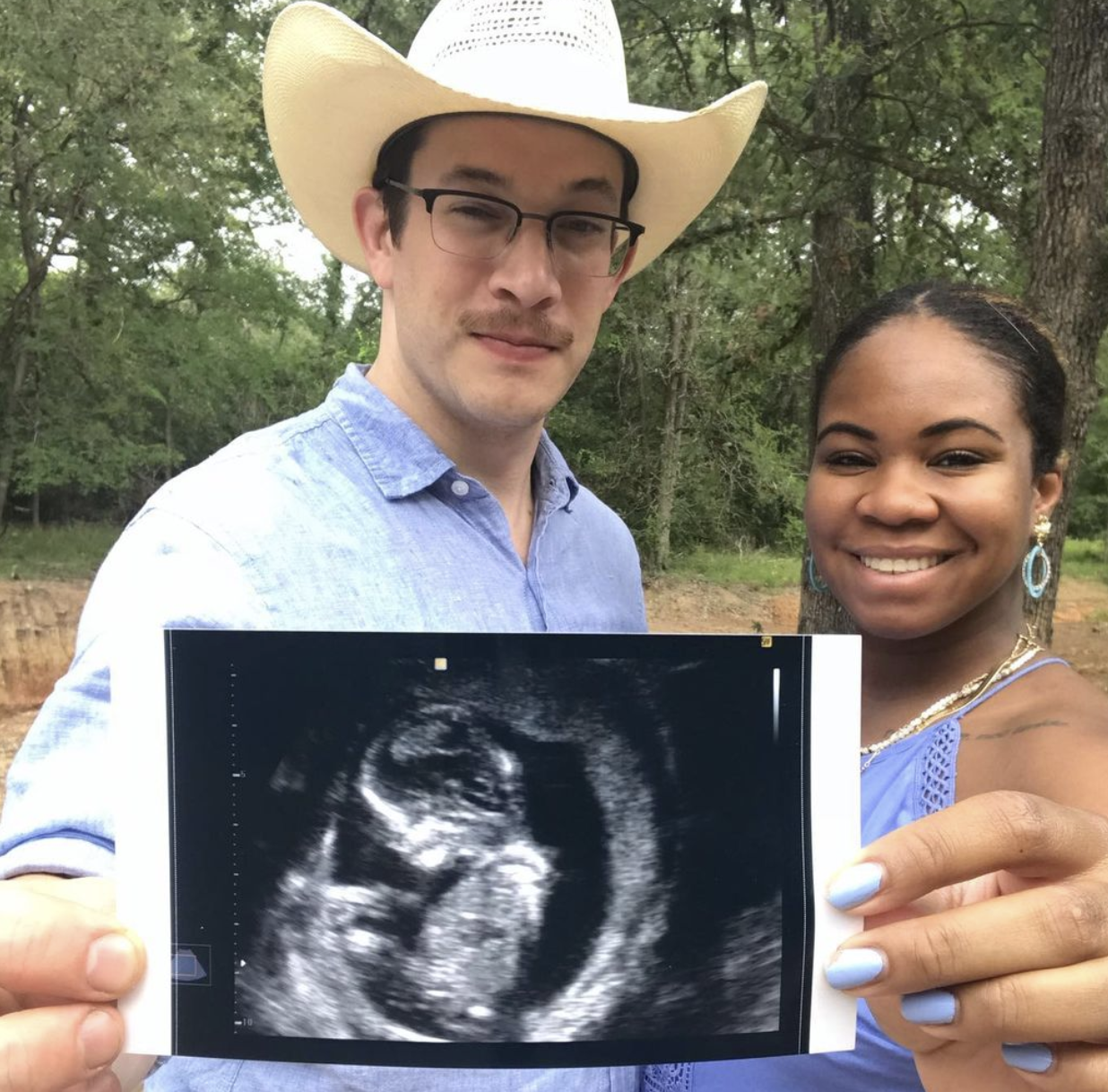 Planned Birth Center Birth Turned Emergency Induction and C-Section