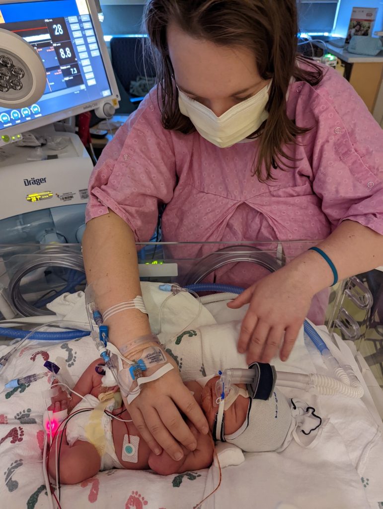 NICU with 34 week preemie