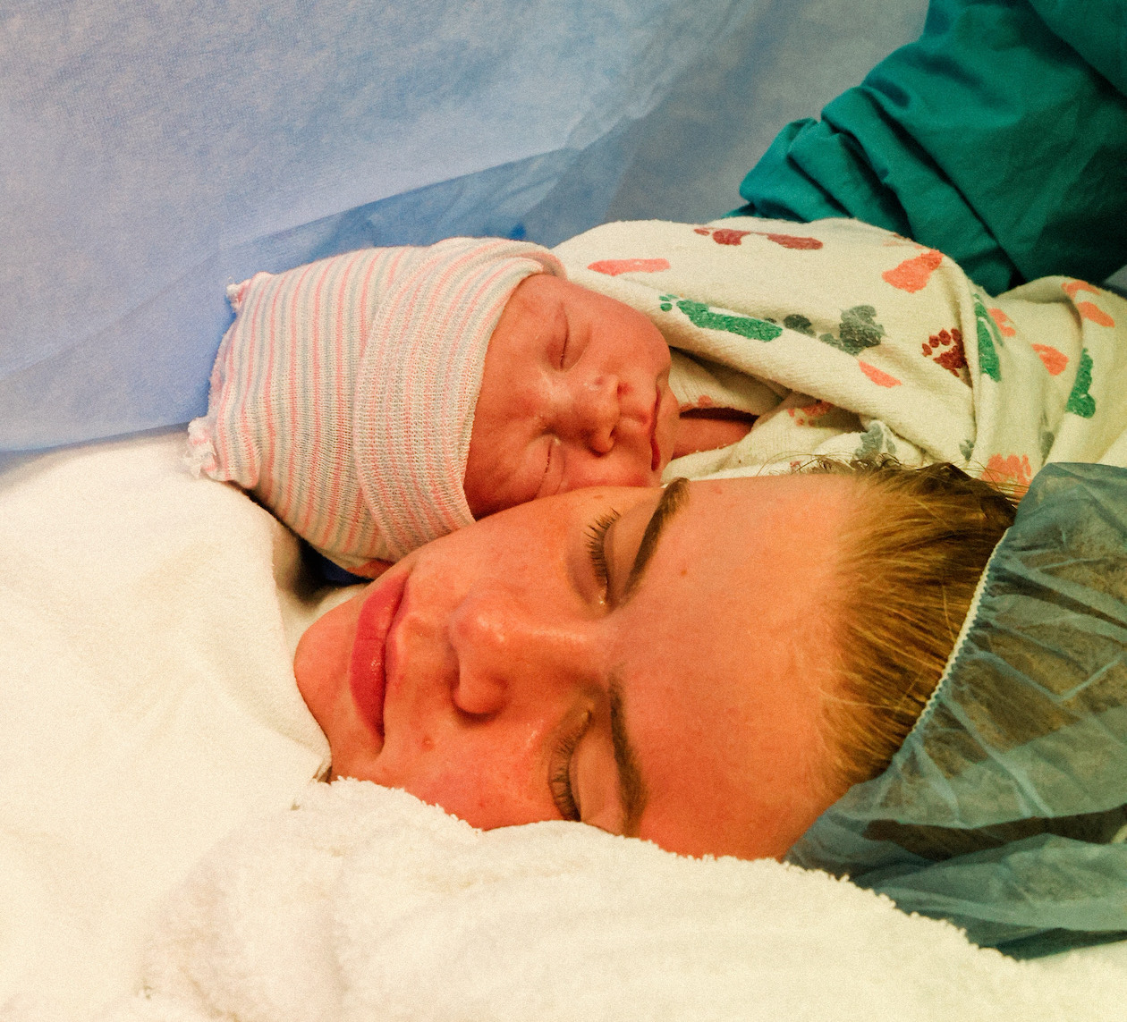 Cesarean Birth after Surprise Preeclampsia & Placental Abruption