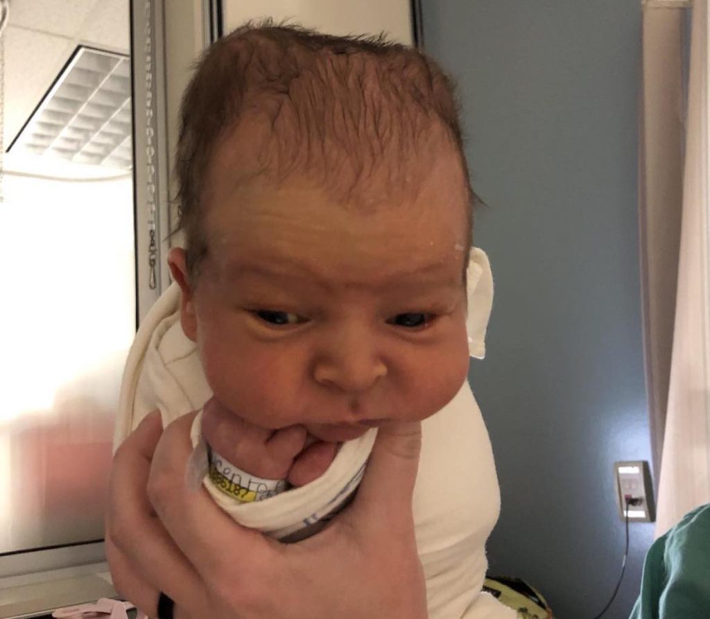 head bumps on newborn