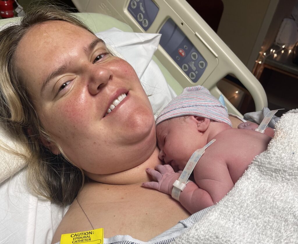 induction without epidural