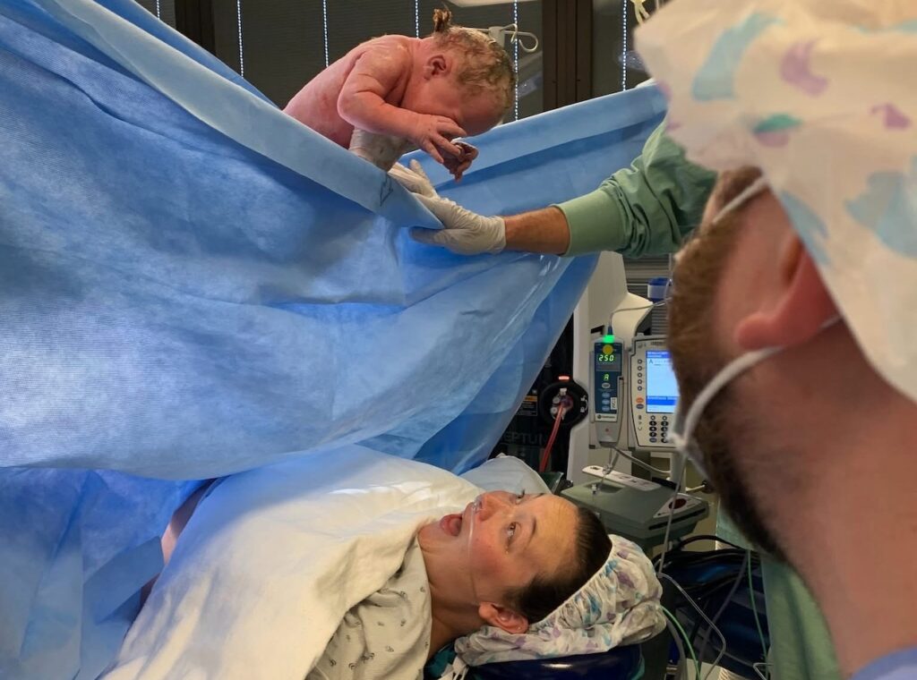 cesarean birth story