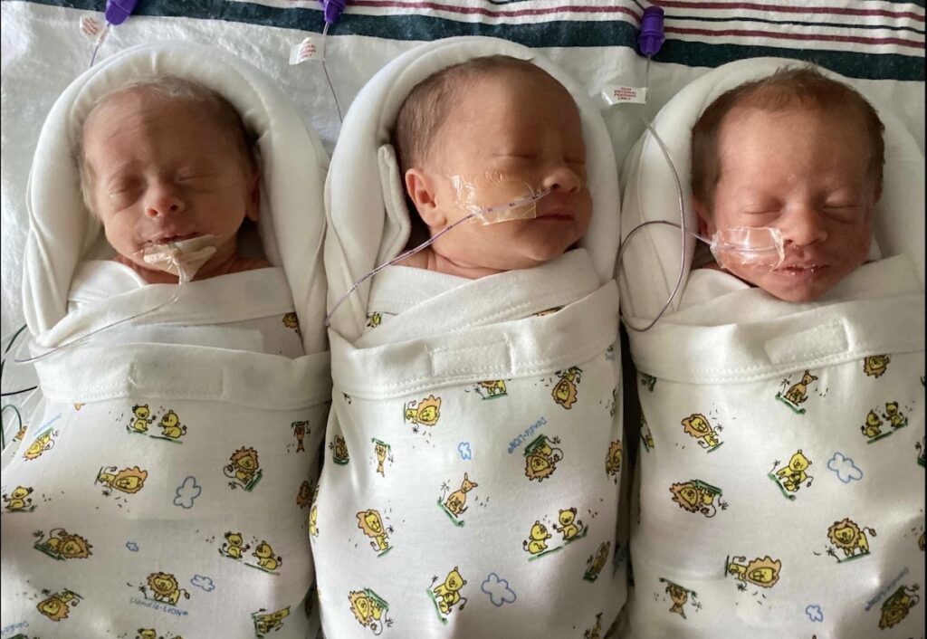 triplets birth story