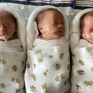 Triplets Pregnancy with Preeclampsia and Cesarean Birth Story followed by NICU Stay and Post-surgical Infection