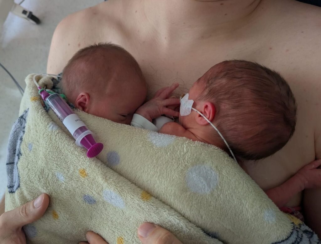 twin pregnancy after breast cancer