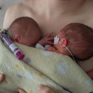 Pregnancy with Twins after Breast Cancer and Giving Birth in Germany